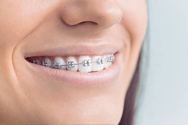 Best Invisalign and Clear Aligners  in Toledo, IL